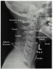 Cranial-Neck picture2.jpg