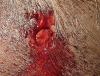 Exitwound14mm.jpg