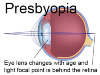 Presbyopia-Featured-Image.png